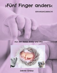Produktbild: F&uuml;nf Finger anders