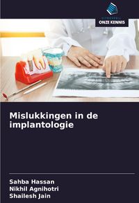 Produktbild: Mislukkingen in de implantologie
