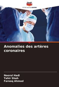 Produktbild: Anomalies des art&egrave;res coronaires