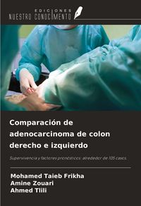 Produktbild: Comparaci&oacute;n de adenocarcinoma de colon derecho e izquierdo