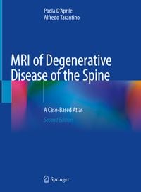 Produktbild: MRI of Degenerative Disease of the Spine