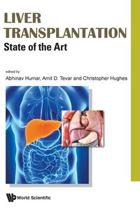 Produktbild: Liver Transplantation