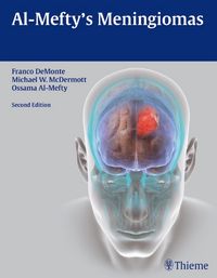 Produktbild: Al-Mefty's Meningiomas