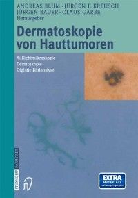 Produktbild: Dermatoskopie von Hauttumoren