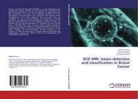Produktbild: DCE-MRI: lesion detection and classification in Breast Cancer