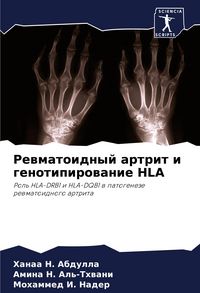 Produktbild: Rewmatoidnyj artrit i genotipirowanie HLA