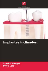 Produktbild: Implantes inclinados