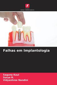 Produktbild: Falhas em Implantologia