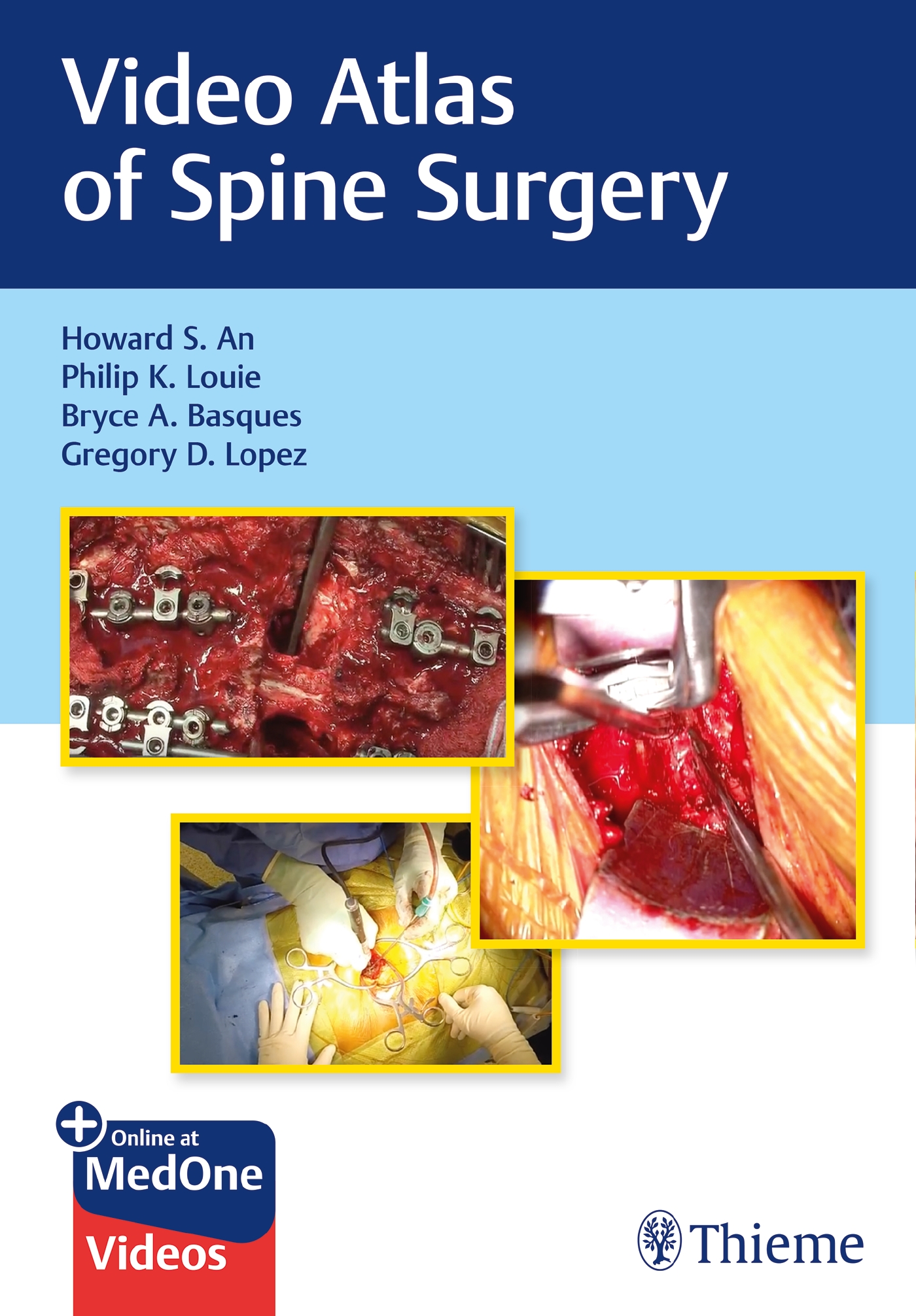 Produktbild: Video Atlas of Spine Surgery