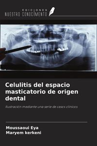 Produktbild: Celulitis del espacio masticatorio de origen dental