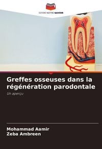 Produktbild: Greffes osseuses dans la r&eacute;g&eacute;n&eacute;ration parodontale