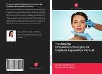 Produktbild: Tratamento Ortod&ocirc;ntico/cir&uacute;rgico da Displasia Esquel&eacute;tica Vertical