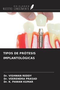 Produktbild: Tipos De Pr&oacute;tesis Implantol&oacute;gicas