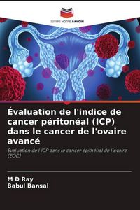 Produktbild: &Eacute;valuation de l'indice de cancer p&eacute;riton&eacute;al (ICP) dans le cancer de l'ovaire avanc&eacute;