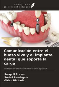 Produktbild: Comunicaci&oacute;n entre el hueso vivo y el implante dental que soporta la carga