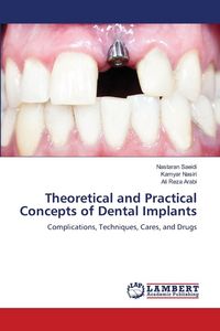 Produktbild: Theoretical and Practical Concepts of Dental Implants