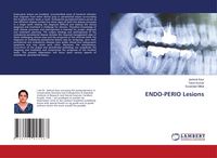 Produktbild: Endo-Perio Lesions