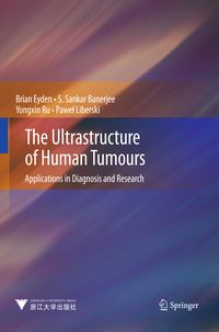 Produktbild: The Ultrastructure of Human Tumours
