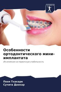 Produktbild: Osobennosti ortodonticheskogo mini-implantata