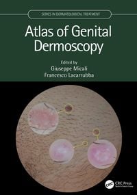 Produktbild: Atlas of Genital Dermoscopy