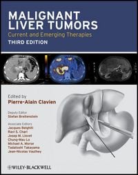 Produktbild: Malignant Liver Tumors