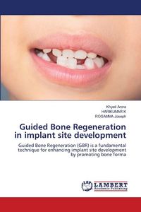Produktbild: Guided Bone Regeneration in implant site development