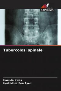 Produktbild: Tubercolosi spinale