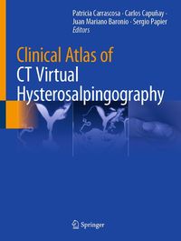 Produktbild: Clinical Atlas of CT Virtual Hysterosalpingography