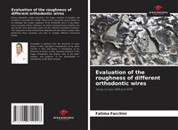 Produktbild: Evaluation of the roughness of different orthodontic wires