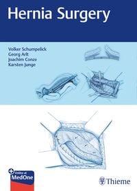 Produktbild: Hernia Surgery