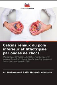 Produktbild: Calculs r&eacute;naux du p&ocirc;le inf&eacute;rieur et lithotripsie par ondes de chocs