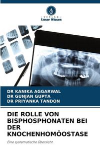 Produktbild: DIE ROLLE VON BISPHOSPHONATEN BEI DER KNOCHENHOM&Ouml;OSTASE
