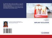 Produktbild: Implant Occlusion