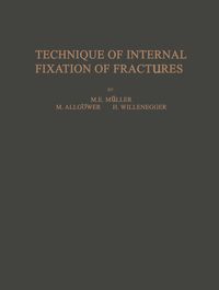 Produktbild: Technique of Internal Fixation of Fractures