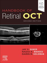 Produktbild: Handbook of Retinal OCT: Optical Coherence Tomography E-Book