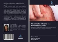 Produktbild: Chronische Urticaria en Helicobacter pylori