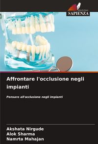 Produktbild: Affrontare l'occlusione negli impianti