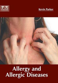 Produktbild: Allergy and Allergic Diseases