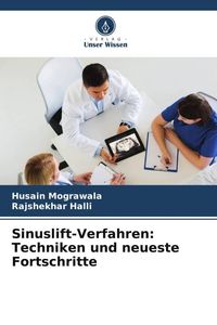 Produktbild: Sinuslift-Verfahren: Techniken und neueste Fortschritte