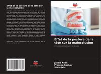 Produktbild: Effet de la posture de la t&ecirc;te sur la malocclusion