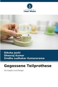 Produktbild: Gegossene Teilprothese