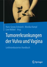 Produktbild: Tumorerkrankungen der Vulva und Vagina