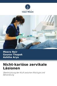 Produktbild: Nicht-kari&ouml;se zervikale L&auml;sionen