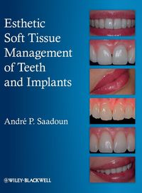 Produktbild: Esthetic Soft Tissue Management of Teeth and Implants