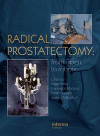 Produktbild: Radical Prostatectomy