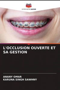 Produktbild: L'occlusion Ouverte Et Sa Gestion