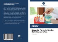 Produktbild: Neueste Fortschritte bei Zahnimplantaten