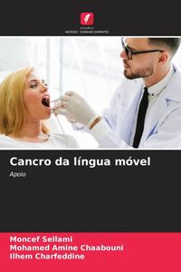 Produktbild: Cancro da l&iacute;ngua m&oacute;vel