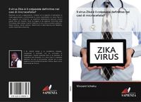 Produktbild: Il virus Zika &egrave; il colpevole definitivo nei casi di microcefalia?