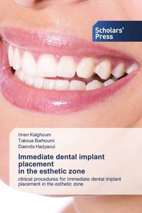 Produktbild: Immediate dental implant placement in the esthetic zone